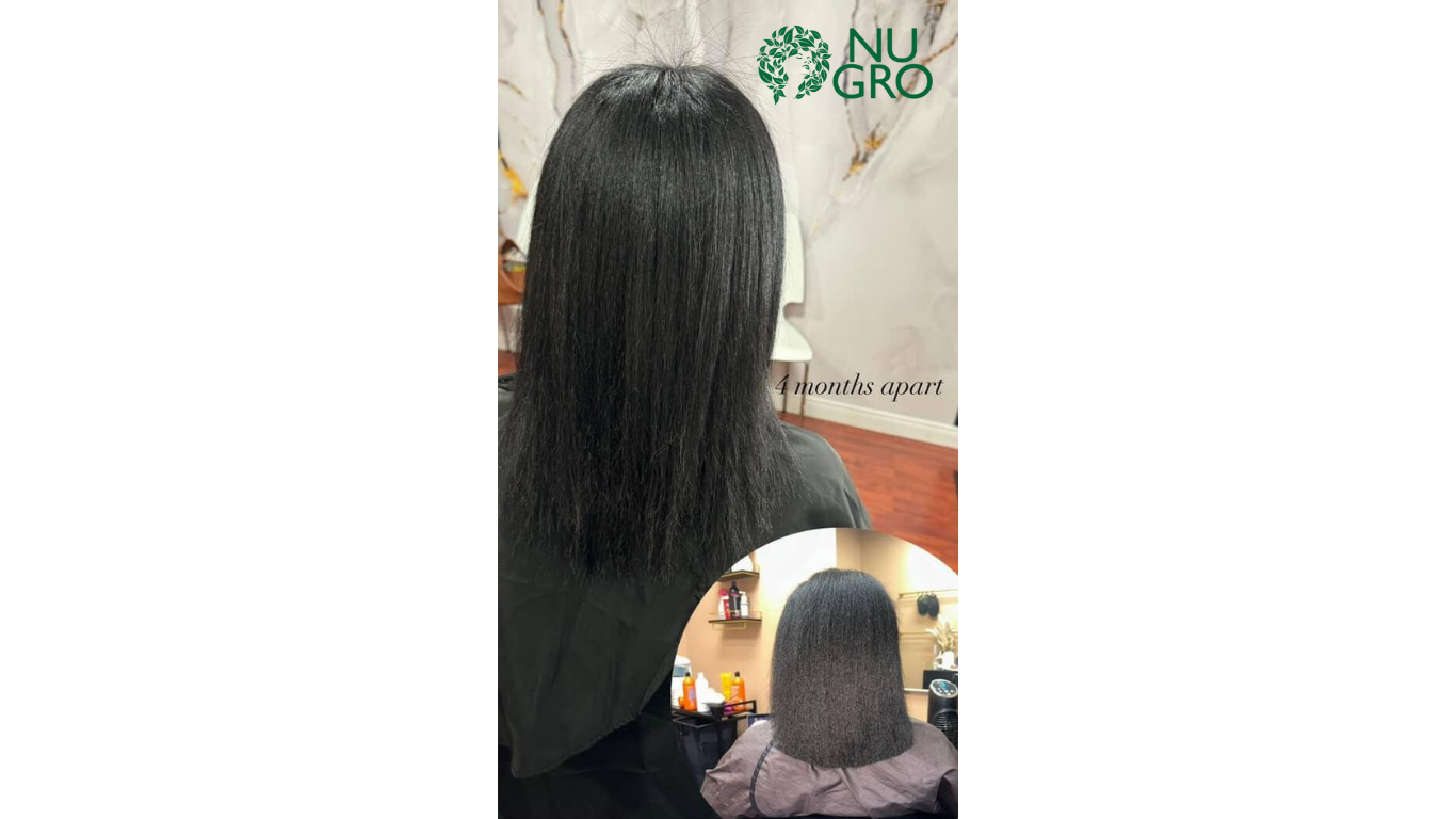 NUGRO Hair